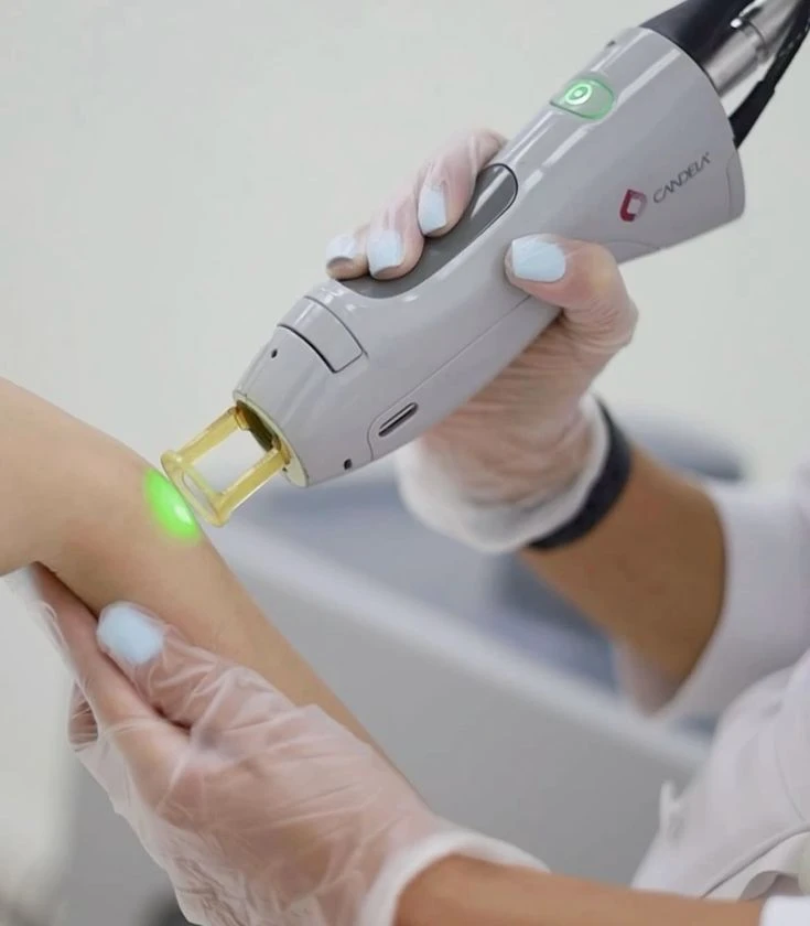 3 laser sessions (excluding abdomen and back)