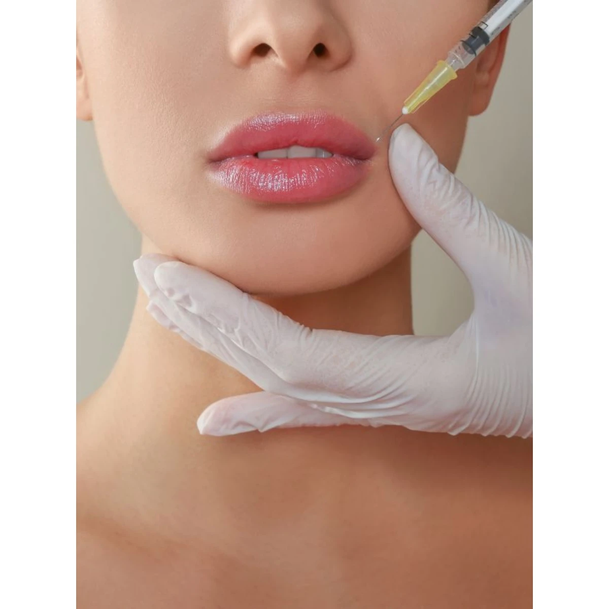 1 ml filler + free skin cleansing